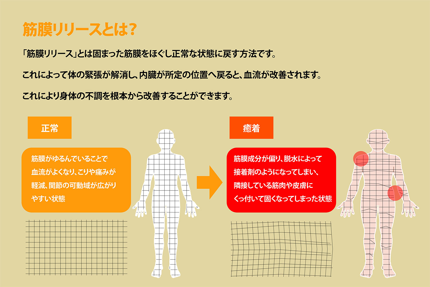 筋膜リリースとは固まった筋肉をほぐし正常な状態に戻す方法です。